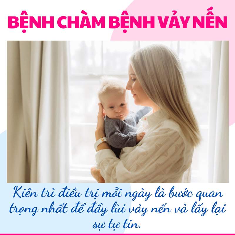 điều trị bệnh vảy nến hiệu quả